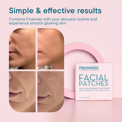 Frownies Facial Patches for Corner of Eyes & Mouth - Anti-Wrinkle Face Tape for Crow's Feet & Smile Lines - Hypoallergenic Overnight Wrinkle Patches (144 Count)