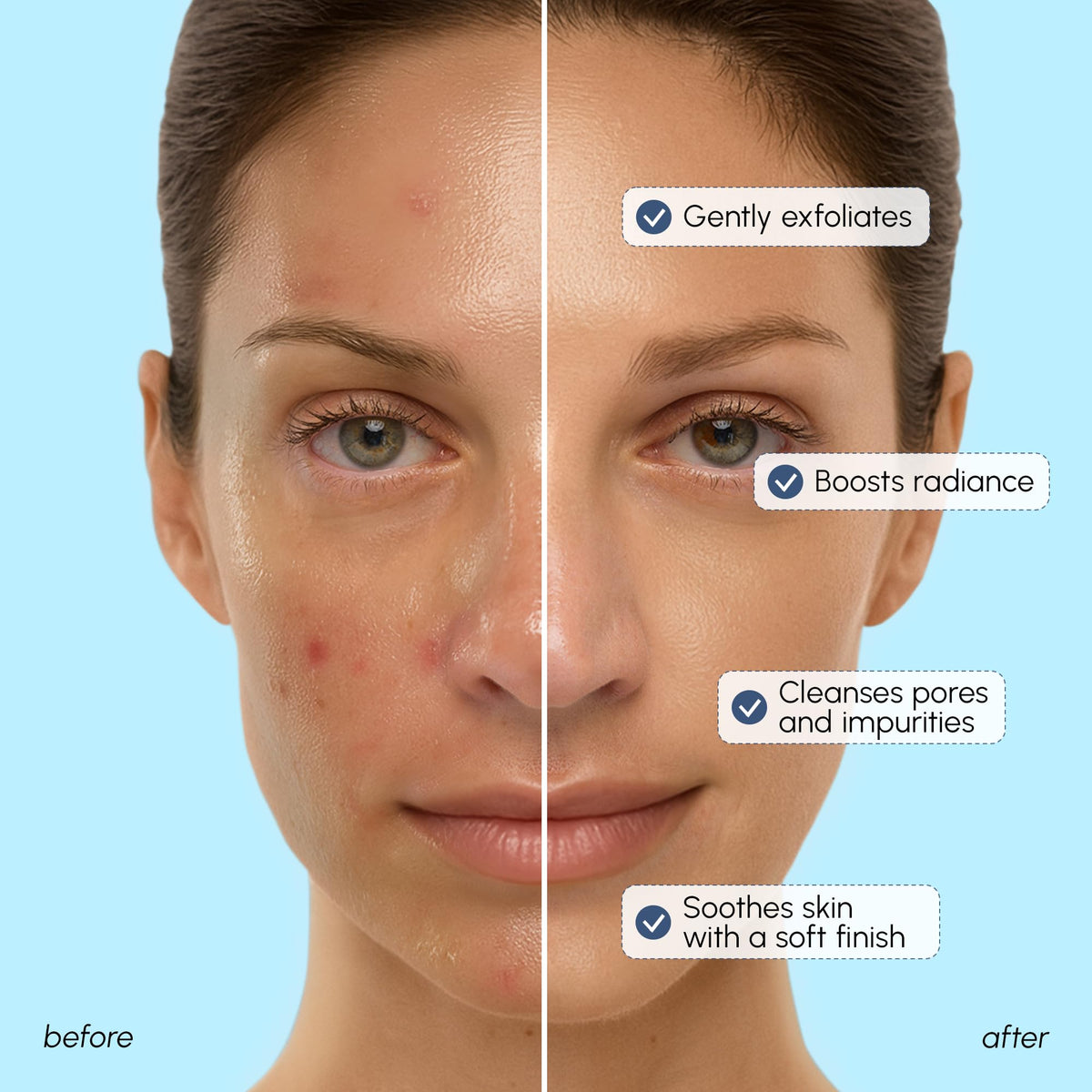 MAREE Face Exfoliator - Microdermabrasion Facial Scrub & Exfoliating Face Wash for Women - Collagen & Glycolic Acid - Gentle Scrub and Exfoliant - Men Exfoliating Scrubber - Exfoliante Facial Cleanser