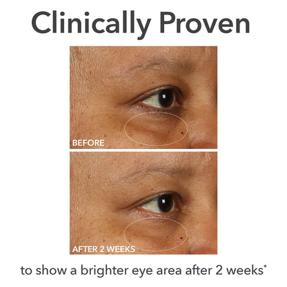Dr Dennis Gross DermInfusions Fill + Repair Eye Cream (0.5 oz)