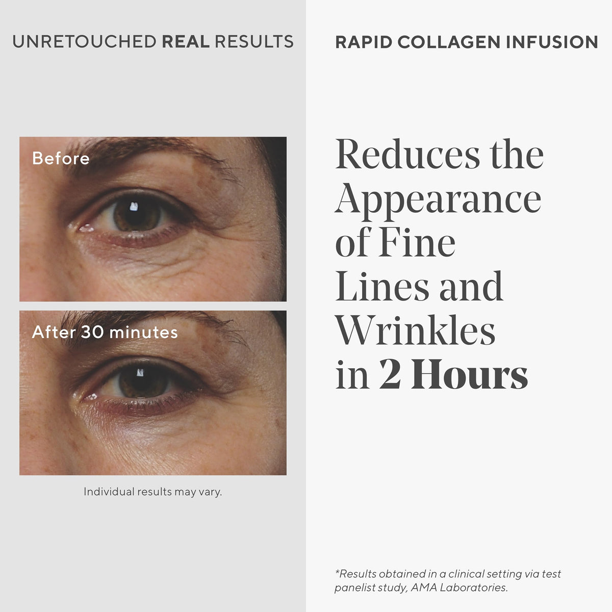 Murad Rapid Collagen Infusion - Anti-Aging Serum with Collagen Amino Acids & Winged Kelp Extract for Visible Wrinkle Reduction, Enhanced Skin Firmness & Re-Volumizes Skin - 1.0 Fl Oz