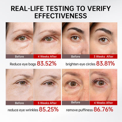 Retinol & Caffeine Eye Serum - 360° Massage Roller (15ml)