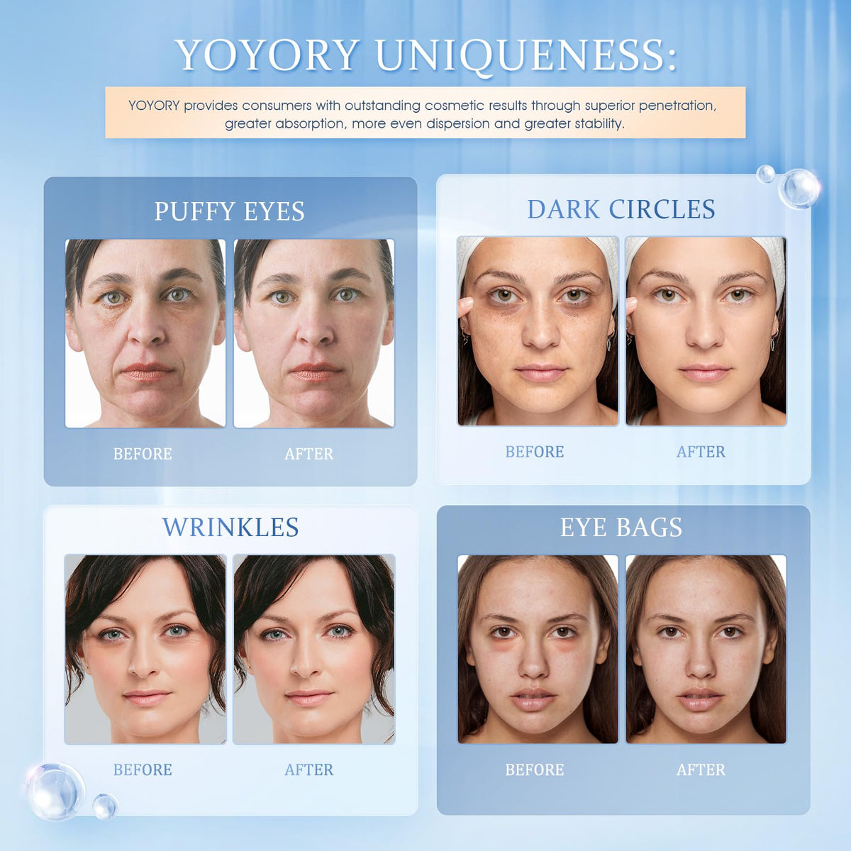 YOYORY Under Eye Patches for Dark Circles & Puffy Eyes - Collagen & Hyaluronic Acid Eye Mask - Anti-Aging & Cooling Treatment (60 Pcs, Blue)