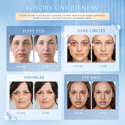 YOYORY Under Eye Patches for Dark Circles & Puffy Eyes - Collagen & Hyaluronic Acid Eye Mask - Anti-Aging & Cooling Treatment (60 Pcs, Blue)