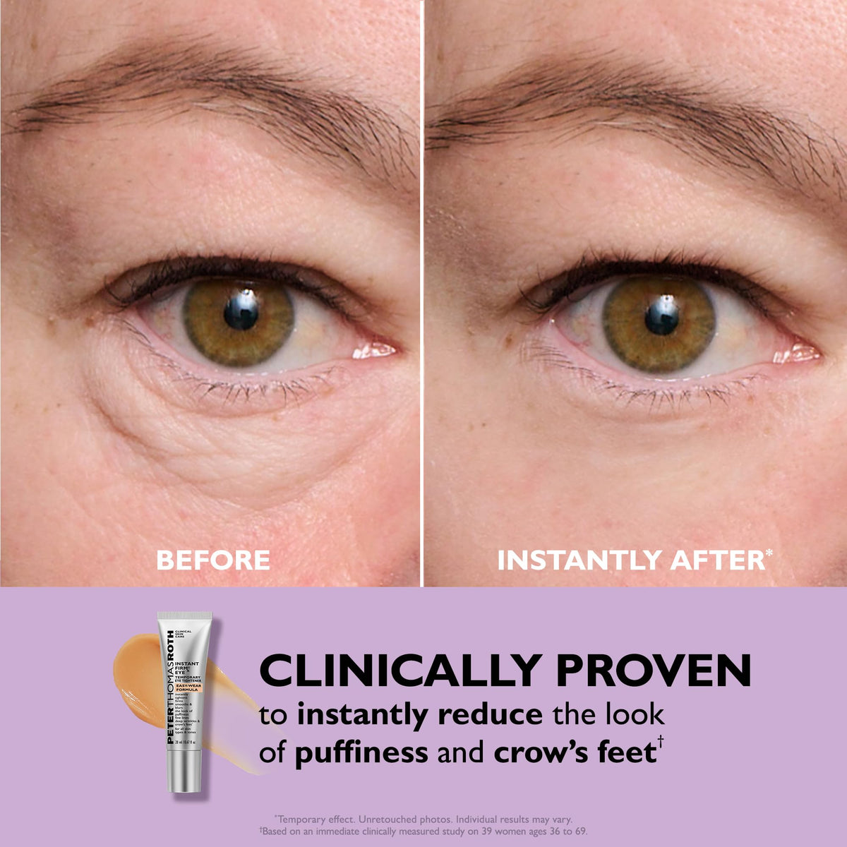 Peter Thomas Roth Instant FIRMx Eye Temporary Eye Tightener - 30ml - Easy-Wear Formula for Instant Eye Lift