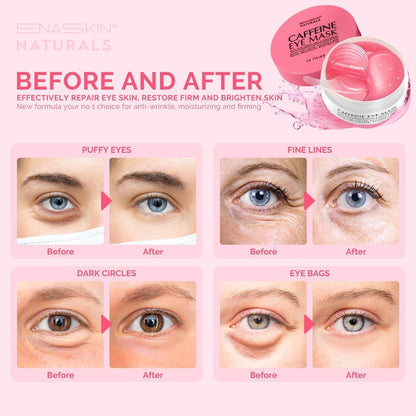 Enaskin Naturals Pink Caffeine Under Eye Patches (2-PACK / 60 Pairs) - Instant Brightening & De-puffing Gel Masks for Dark Circles & Bags