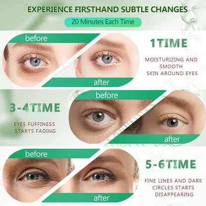 Yargkos Green Tea Collagen Under Eye Patches - 60 Pcs (30 Pairs)