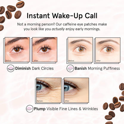 grace & stella Caffeine & Bronze Under Eye Patches - 48 Pairs - Niacinamide & Hyaluronic Acid Vegan Gel Masks for Puffy Eyes