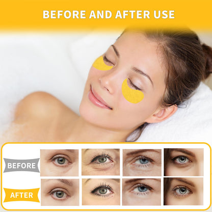 Qyiywim 24K Gold Under Eye Patches - 70 PCS Eye Gel Pads for Dark Circles, Puffiness & Eye Bags