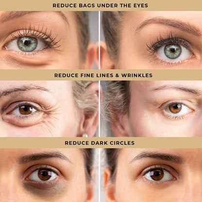 LPH LAB Temporary Eye Tightener - Instant Under-Eye Bag & Dark Circle Remover (0.5 oz)