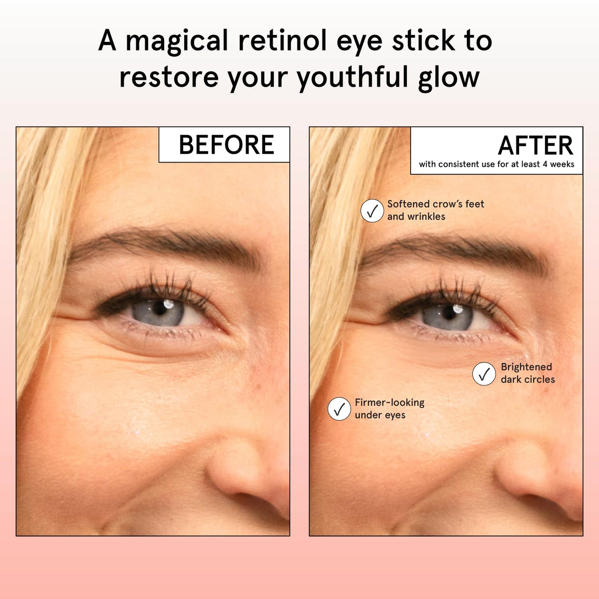 grace & stella Retinol & Caffeine Eye Brightener Balm Stick (3.5g) - Travel-Size Anti-Aging Treatment for Dark Circles, Puffiness & Wrinkles - Vegan Eye Cream Stick