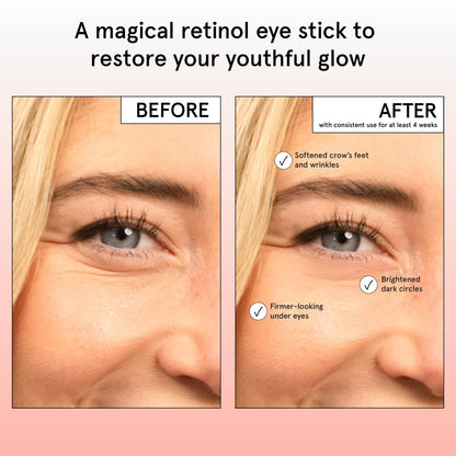 grace & stella Retinol & Caffeine Eye Brightener Balm Stick (3.5g) - Travel-Size Anti-Aging Treatment for Dark Circles, Puffiness & Wrinkles - Vegan Eye Cream Stick