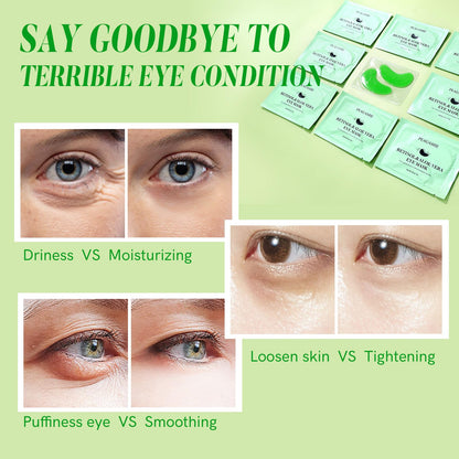PEAUAMIE Retinol & Aloe Vera Under Eye Patches (30 Pairs) - Intensive Anti-Aging & Soothing Eye Mask for Wrinkles, Dark Circles & Puffiness