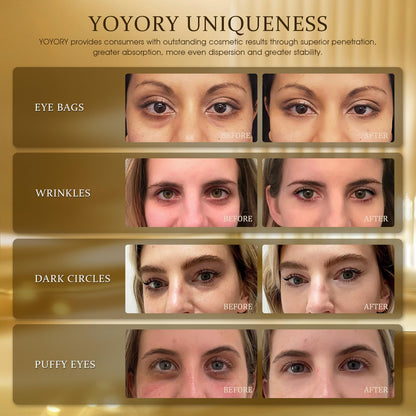 YOYORY 24K Gold Under Eye Patches - Anti-Aging Treatment for Dark Circles, Puffy Eyes & Wrinkles - Collagen & Hyaluronic Acid (60 Pcs)
