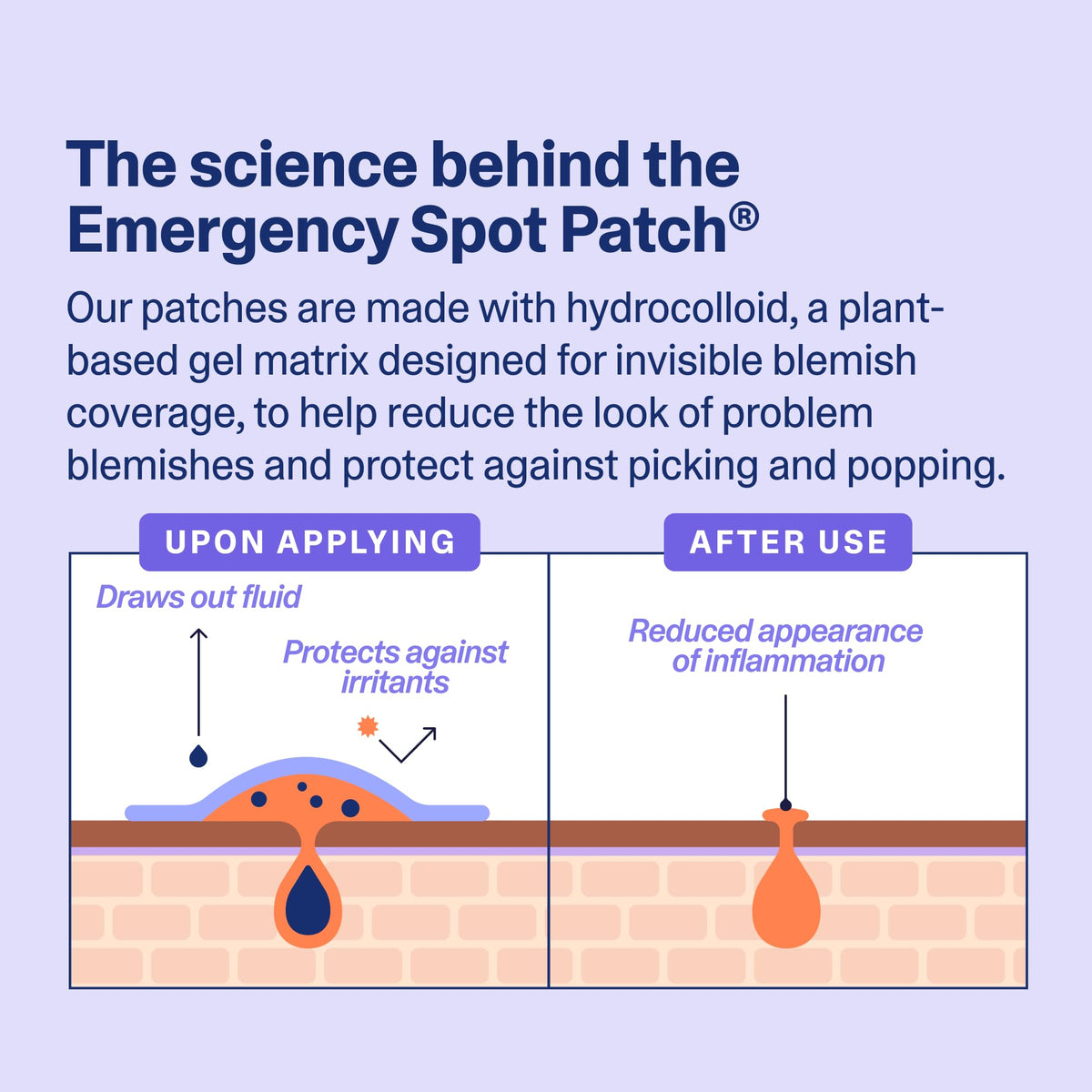 Curology Emergency Spot Pimple Patches for Face, Hydrocolloid Pimple Patches Fast-Acting, 40 Count