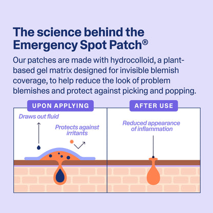Curology Emergency Spot Pimple Patches for Face, Hydrocolloid Pimple Patches Fast-Acting, 40 Count