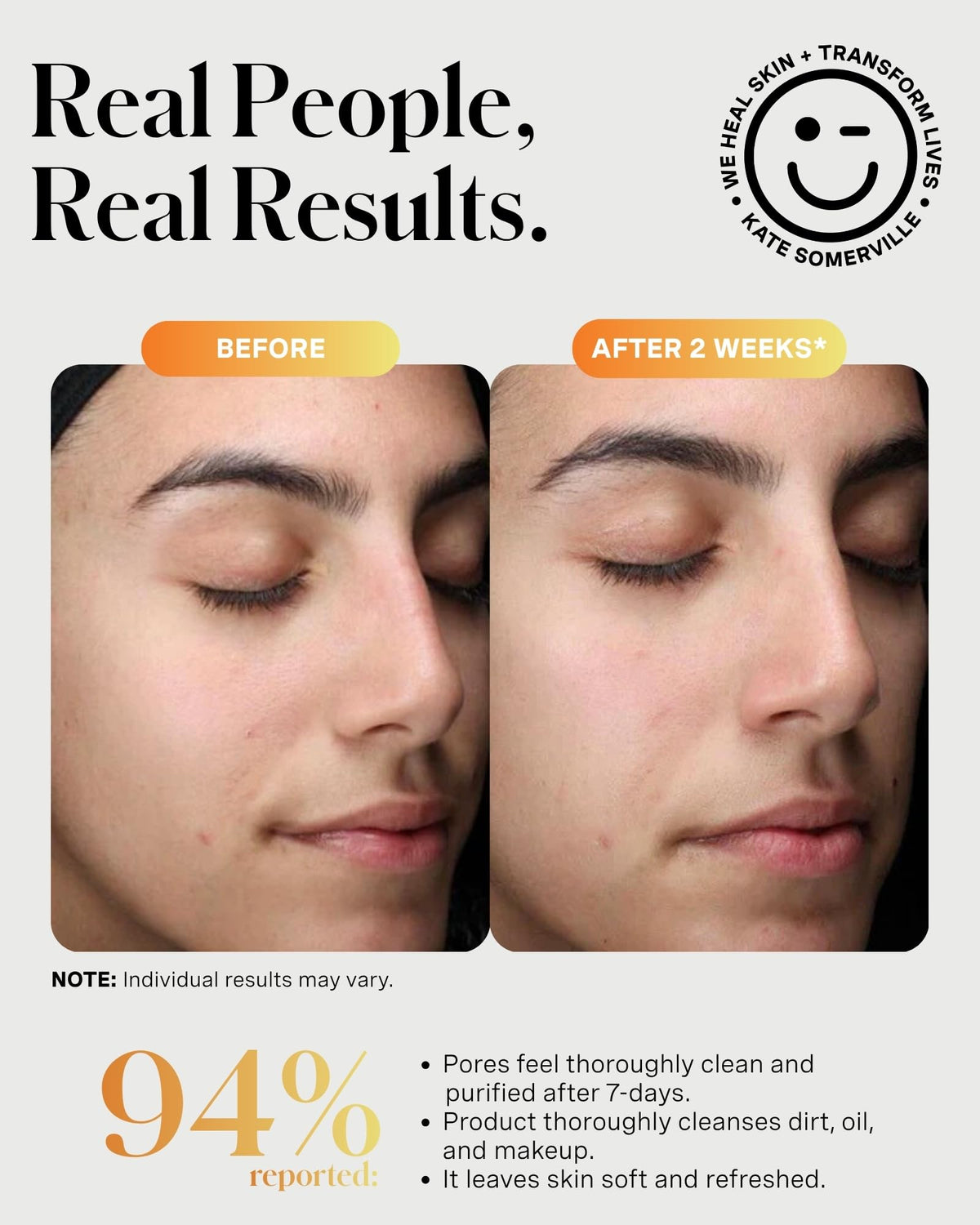 Kate Somerville ExfoliKate Cleanser - Daily Exfoliating Foaming Face Wash, Clinically Formulated Glycolic Acid and Lactic Acid Gentle Facial Scrub, 8 Fl Oz