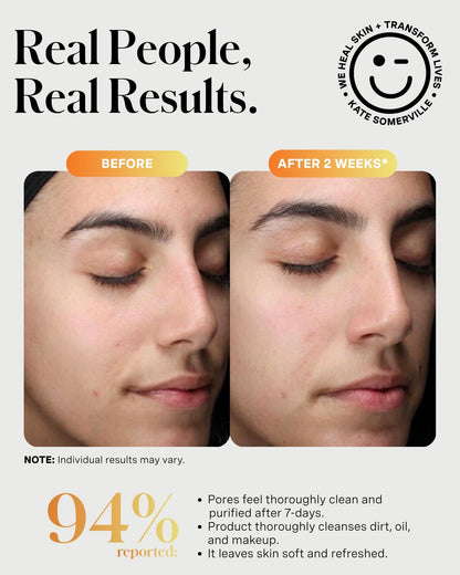 Kate Somerville ExfoliKate Cleanser - Daily Exfoliating Foaming Face Wash, Clinically Formulated Glycolic Acid and Lactic Acid Gentle Facial Scrub, 8 Fl Oz