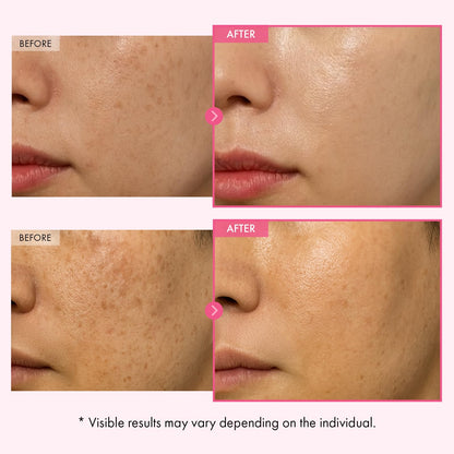 TOSOWOONG Arbutin 7% Glutathione Cream, 70,000ppm Arbutin + 5,001ppm Glutathione, Niacinamide, Dark Spots, Freckle, Blemishes, Pigmentation, Dullness, Uneven Tone, Korean Skin Care, 50ml, 1.69 fl.oz.