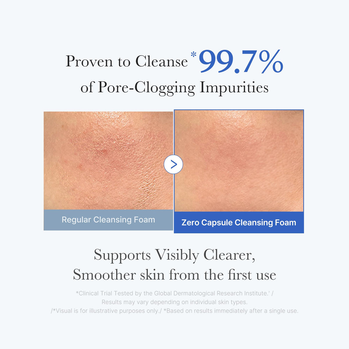 medicube Facial Cleanser Zero Pore Capsule Cleansing Foam - Daily Gentle Cleanser for Skin Texture, Blackhead & Pore Care - AHA, BHA & PHA for Deep Cleansing - Korean Skincare, 4.23 oz