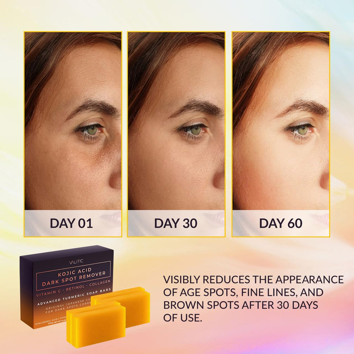 VALITIC Kojic Acid Cleansing Soap Bars with Vitamin C & Turmeric, Hydrating Formula 4 Pack