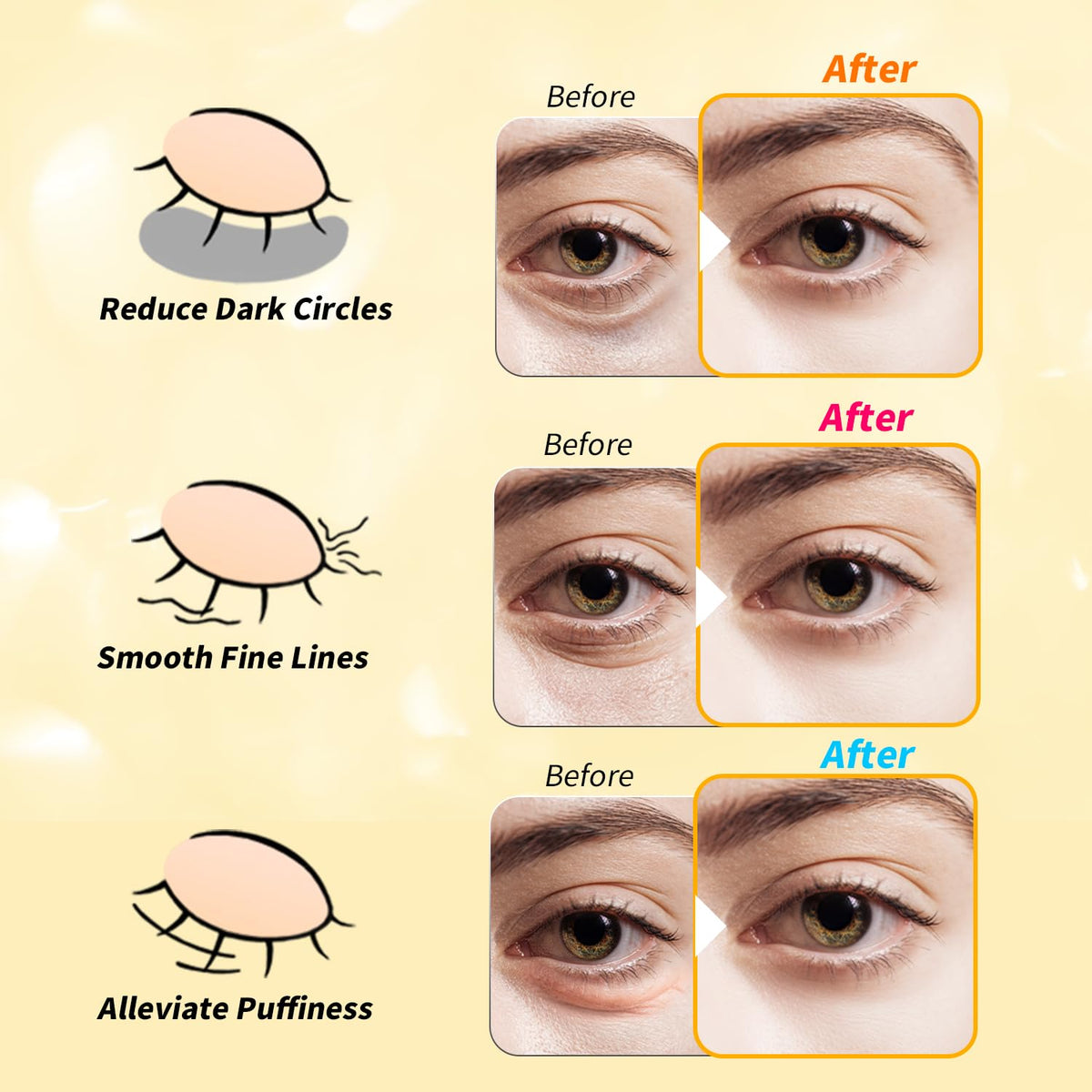 24K Gold & Retinol Under Eye Patches - Caffeine Eye Mask for Puffy Eyes & Dark Circles - Valentines Day Small Gift (12 Pairs)