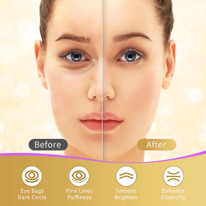 24K Gold, Rose & Aloe Vera Under Eye Patches - 20 Pairs - Multi-Treatment Eye Masks for Dark Circles, Puffiness & Wrinkles