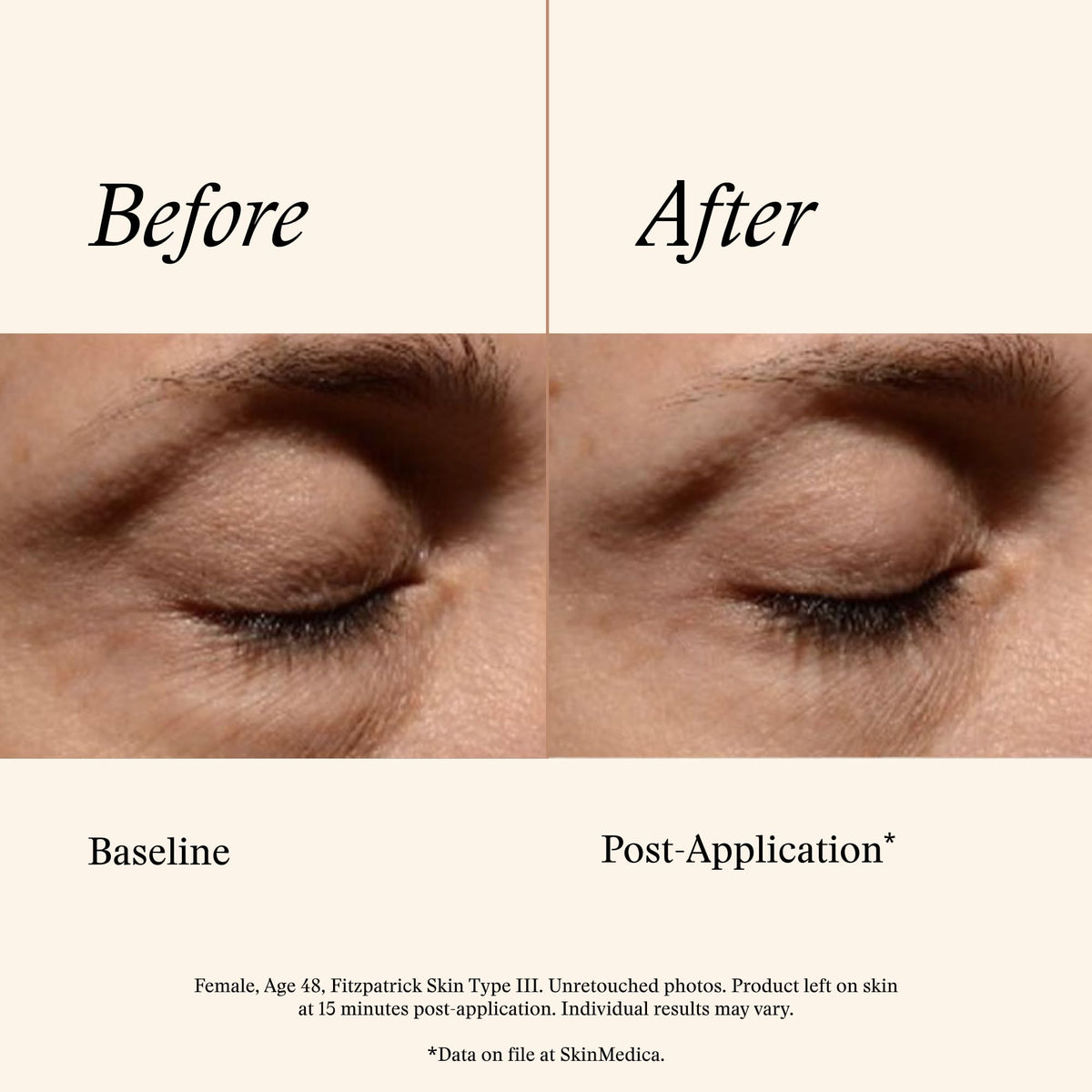 SkinMedica Instant Bright Eye Cream - Advanced Age-Defying (15g)
