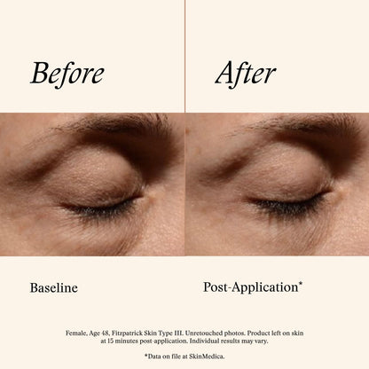 SkinMedica Instant Bright Eye Cream - Advanced Age-Defying (15g)