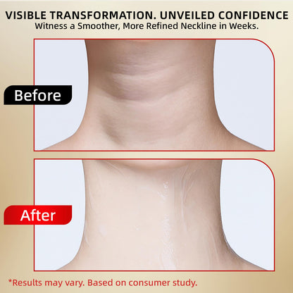 Redcool Retinol Neck Firming Cream - Collagen & Hyaluronic Acid Neck Tightening Anti-Aging Moisturizer 1.76 oz