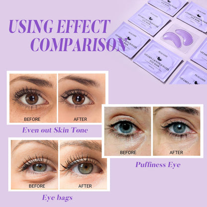 PEAUAMIE Under Eye Patches (30 Pairs) - Brightening Vitamin C & Soothing Witch Hazel Eye Mask for Dark Circles & Puffiness