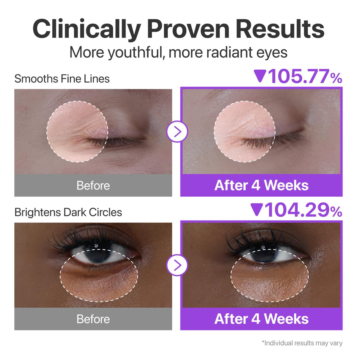 numbuzin No.9 NAD+ Retinol Eye Cream - Depuffing & Firming Eye Serum for Dark Circles, Wrinkles & Fine Lines - With Peptides & Niacinamide (0.33 fl oz.)