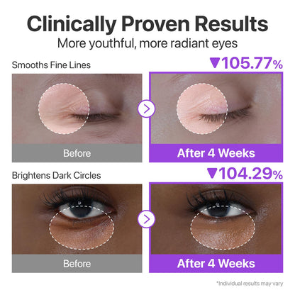 numbuzin No.9 NAD+ Retinol Eye Cream - Depuffing & Firming Eye Serum for Dark Circles, Wrinkles & Fine Lines - With Peptides & Niacinamide (0.33 fl oz.)
