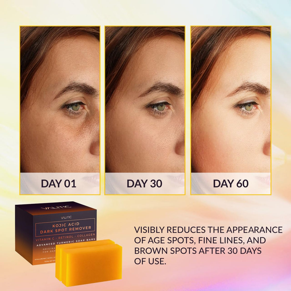 VALITIC Kojic Acid Cleansing Soap Bars with Vitamin C & Turmeric, Hydrating Formula 3.5 oz, 2 Pack with Holder