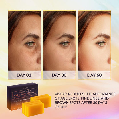 VALITIC Kojic Acid Cleansing Soap Bars with Vitamin C & Turmeric, Hydrating Formula 5 Pack