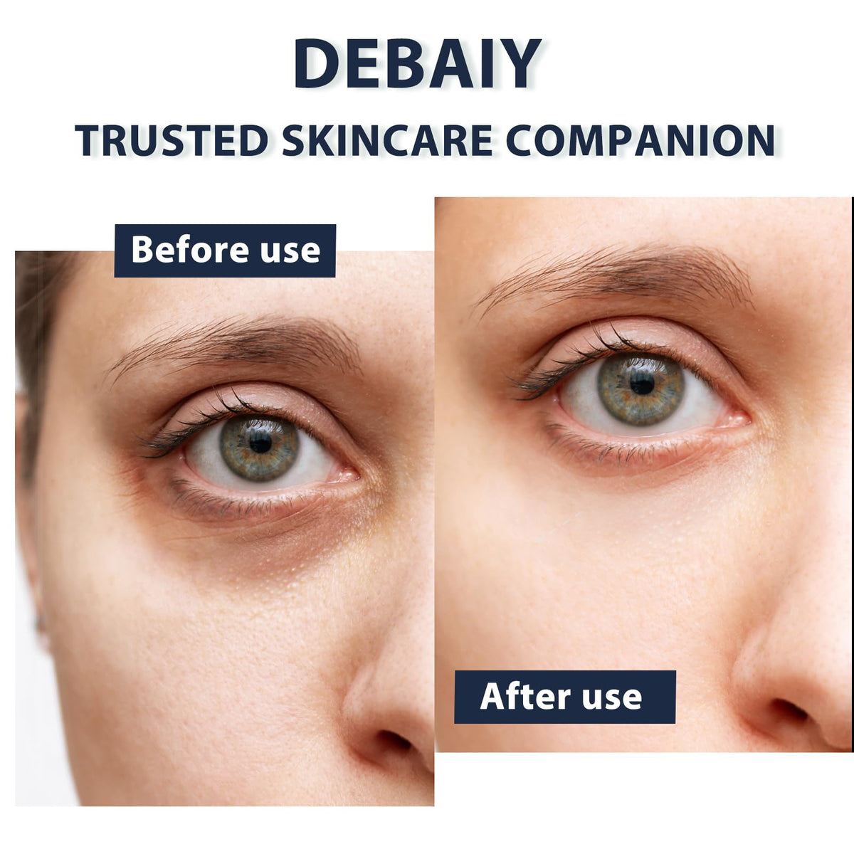 DEBAIY 3% Caffeine Eye Cream for Dark Circles & Puffiness - Anti-Aging Under Eye Treatment for Bags, Night Repair Eye Cream (3 Pack)