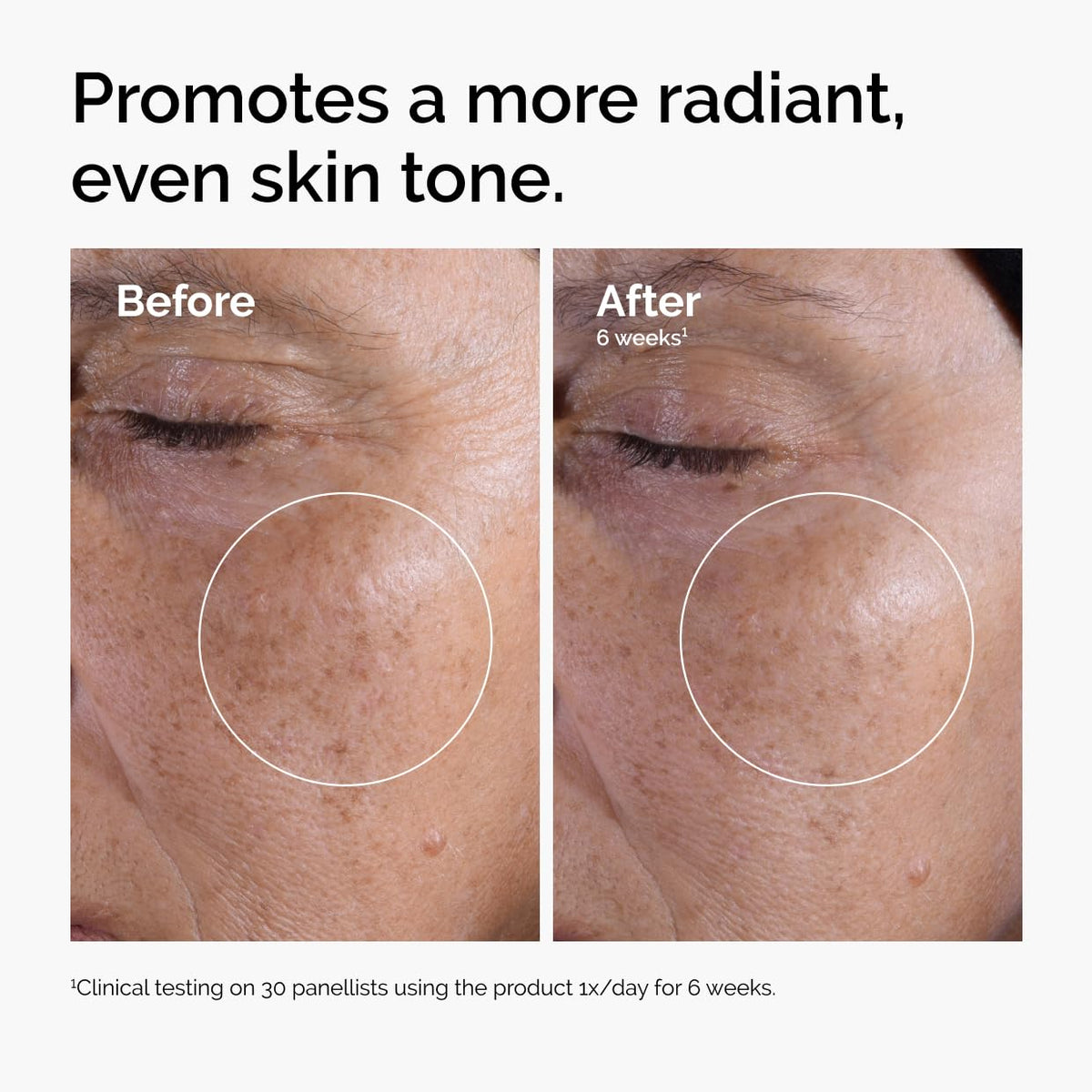 The Ordinary Glycolic Acid 7% Exfoliating Toner, Brightening and Smoothing Daily Toner for More Even-Looking Skin Tone, 8.1 Fl Oz