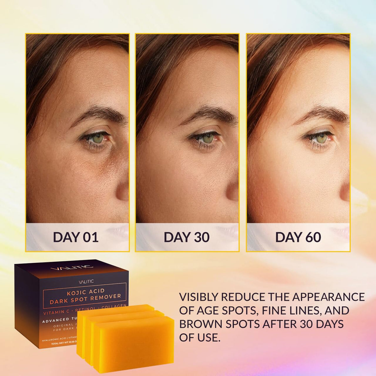 VALITIC Kojic Acid Cleansing Soap Bars with Vitamin C & Turmeric, Hydrating Formula 3 Pack