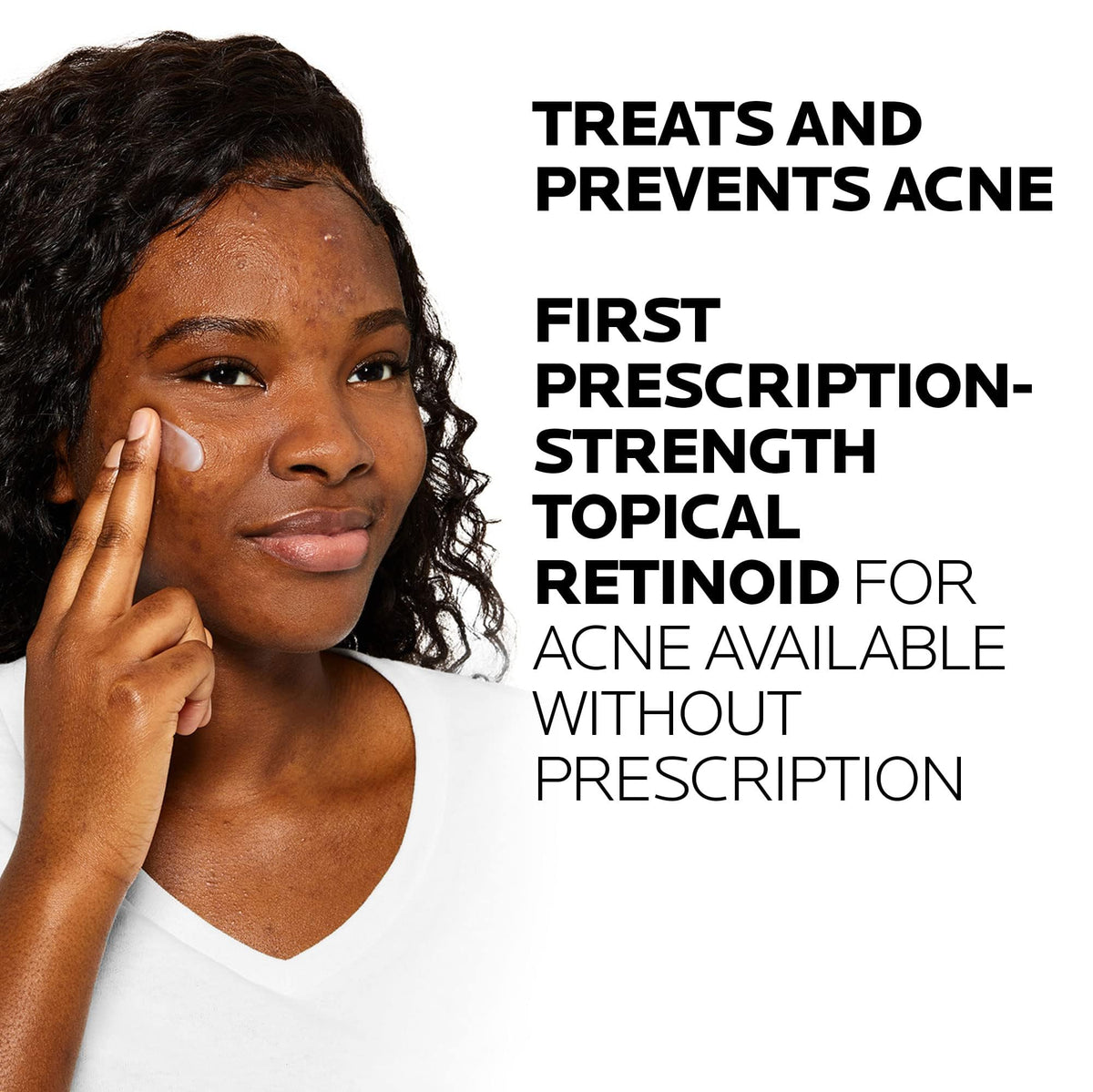 La Roche-Posay Effaclar Adapalene Gel 0.1% Acne Treatment, Retinoid Cream, Acne Medication Gel for Blackheads & Whiteheads, Oil Free, Helps Clear and