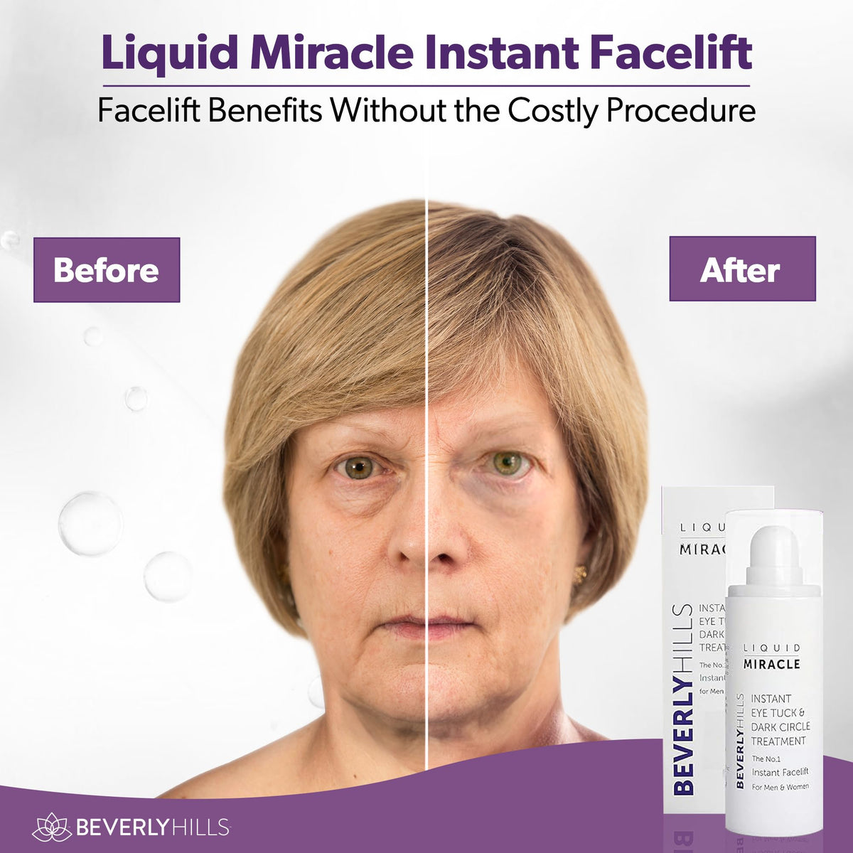 Beverly Hills Instant Facelift & Eye Serum - 30mL (120 Day Supply) - Rapid Reduction Treatment for Bags, Wrinkles & Dark Circles