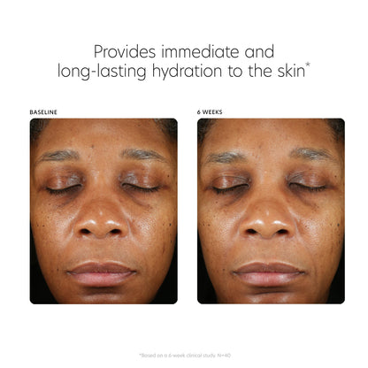 PCA SKIN Hyaluronic Acid Boosting Face Serum - Anti Aging Hydrating Facial Corrector with Niacinamide for Smoothing Wrinkles & Fine Lines (3 fl oz)