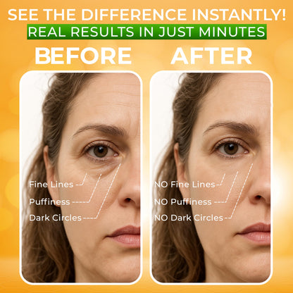 SEAMANTIKA Puffy Eye Treatment (0.8 fl.oz) - Instant Eye Lift for Dark Circles, Bags & Wrinkles with Green Tea & Dead Sea Minerals