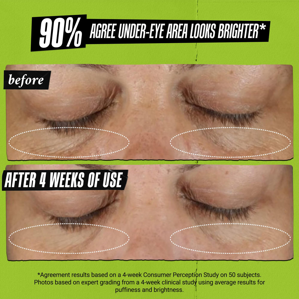 Kiehl's Avocado Eye Treatment (0.5 fl oz) - Nourishing & Hydrating Eye Cream with Avocado Oil and Caffeine - 99% Naturally Derived