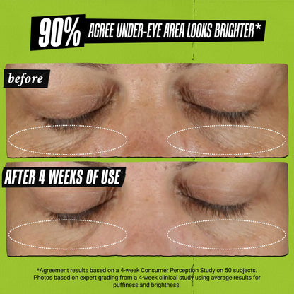 Kiehl's Avocado Eye Treatment (0.5 fl oz) - Nourishing & Hydrating Eye Cream with Avocado Oil and Caffeine - 99% Naturally Derived