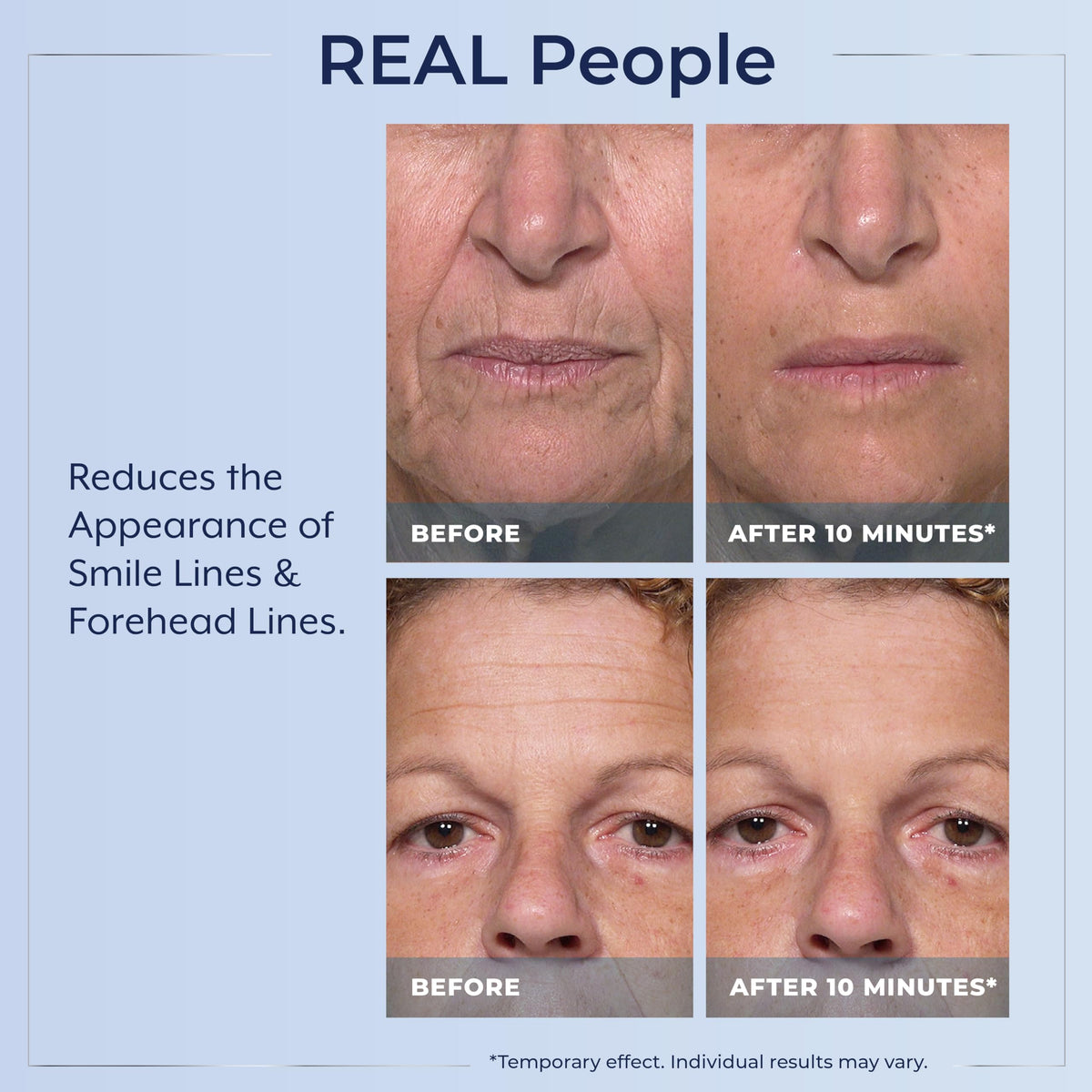 Plexaderm Rapid Reduction Eye Serum - Full Size Tube - Instant Visible Reduction of Eye Bags, Wrinkles & Dark Circles