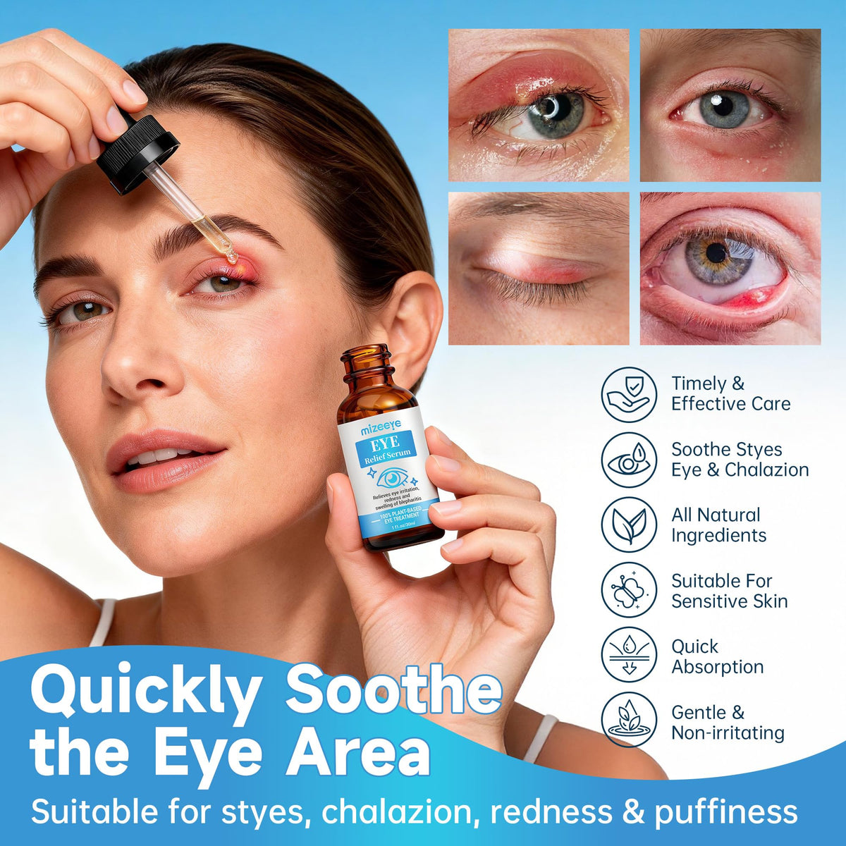 Eye Serum for Chalazion & Blepharitis - Eyelid Relief Set (2 PCS)