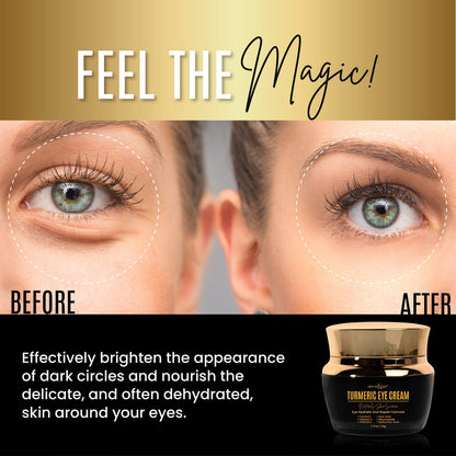 Dermaxgen Vitamin C + Turmeric Eye Cream for Dark Circles & Puffiness - Hydrating & Brightening Under Eye Treatment (1.7 fl. oz / 50ml)