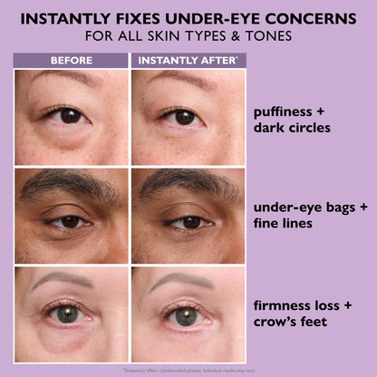 Peter Thomas Roth Instant FIRMx Eye Temporary Eye Tightener - 30ml - Easy-Wear Formula for Instant Eye Lift