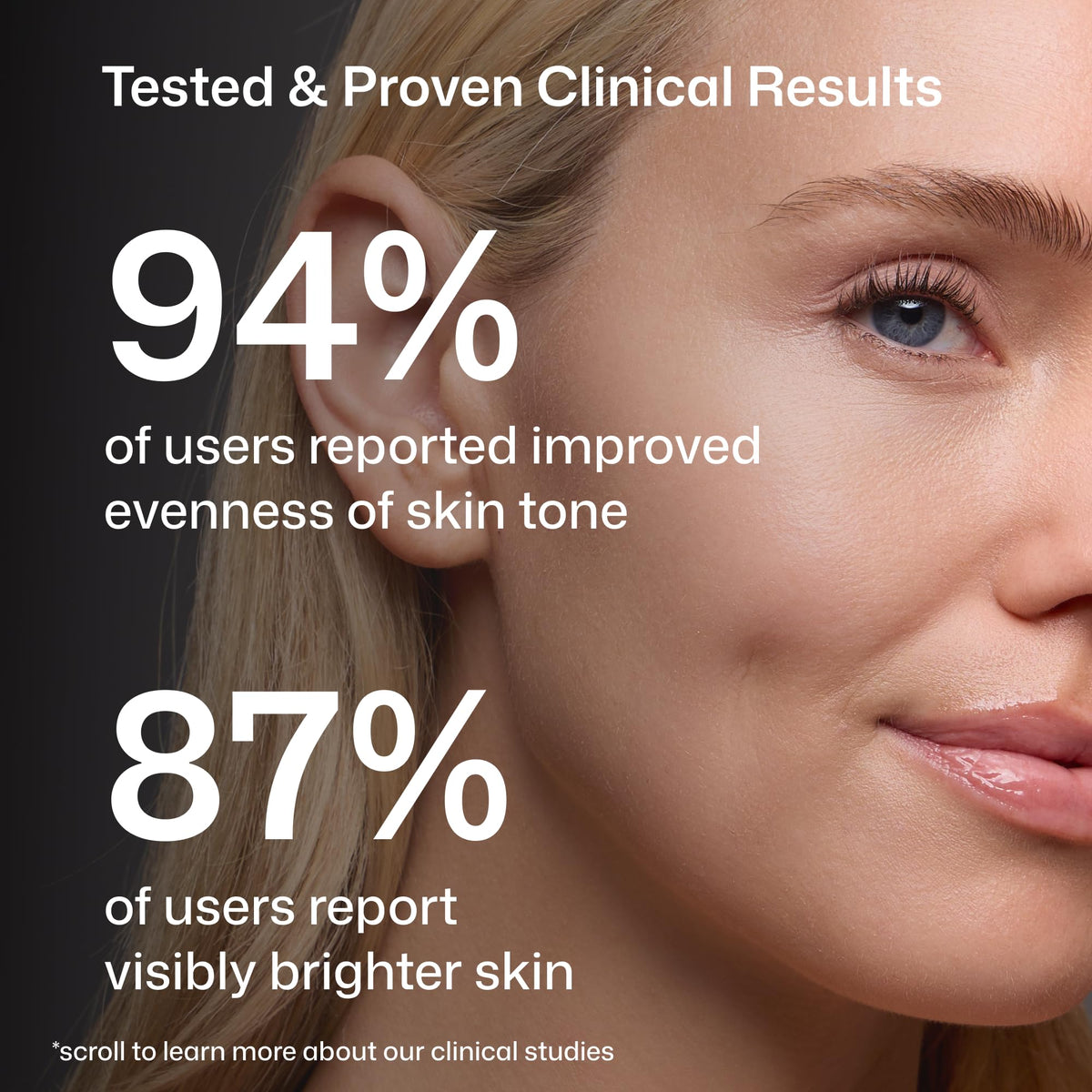 Revision Skincare C+ Correcting Complex 30%, Anti Aging Antioxidant Blend with Vitamin C, Supports Healthy Skin, 1 fl oz