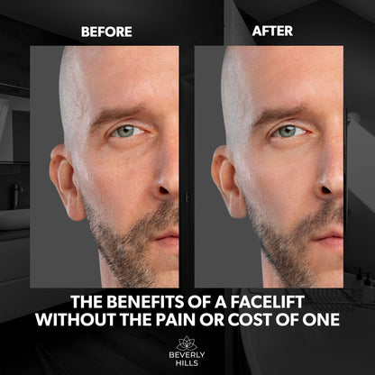 Beverly Hills Men's Instant Facelift & Eye Serum - Dark Circles, Puffy Eyes & Wrinkle Treatment