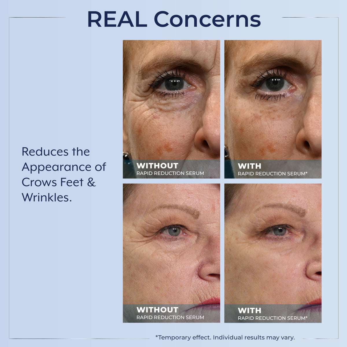 Plexaderm Rapid Reduction Eye Serum - Full Size Tube - Instant Visible Reduction of Eye Bags, Wrinkles & Dark Circles